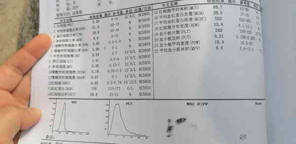 在线体检报告查看：网站查询体检报告单及结果方法