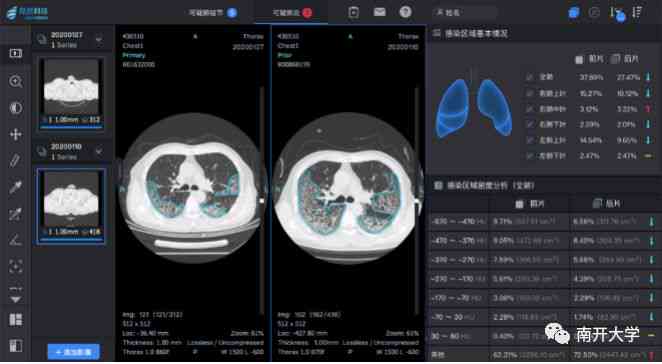 ai可以解读体检报告吗