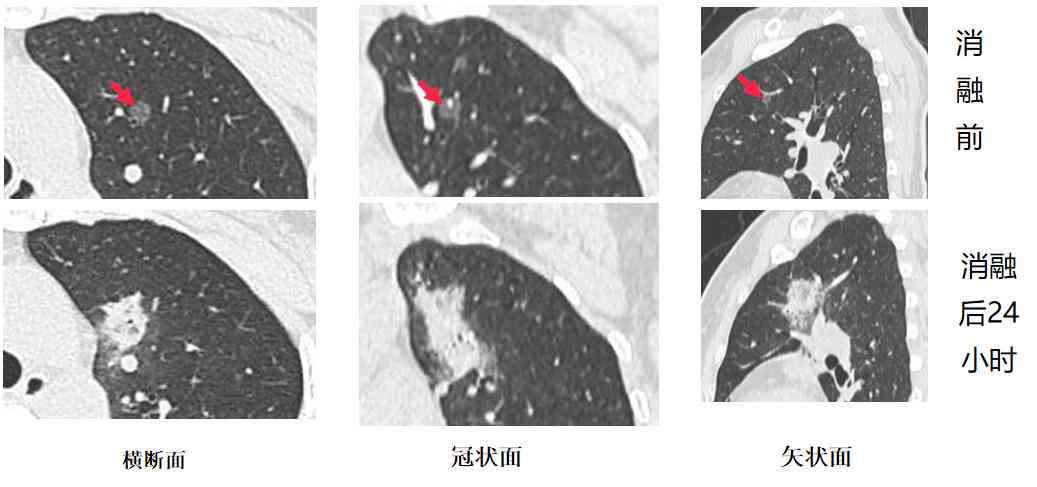 超声AI诊断论文题目大全：最新     及3000字范文精选