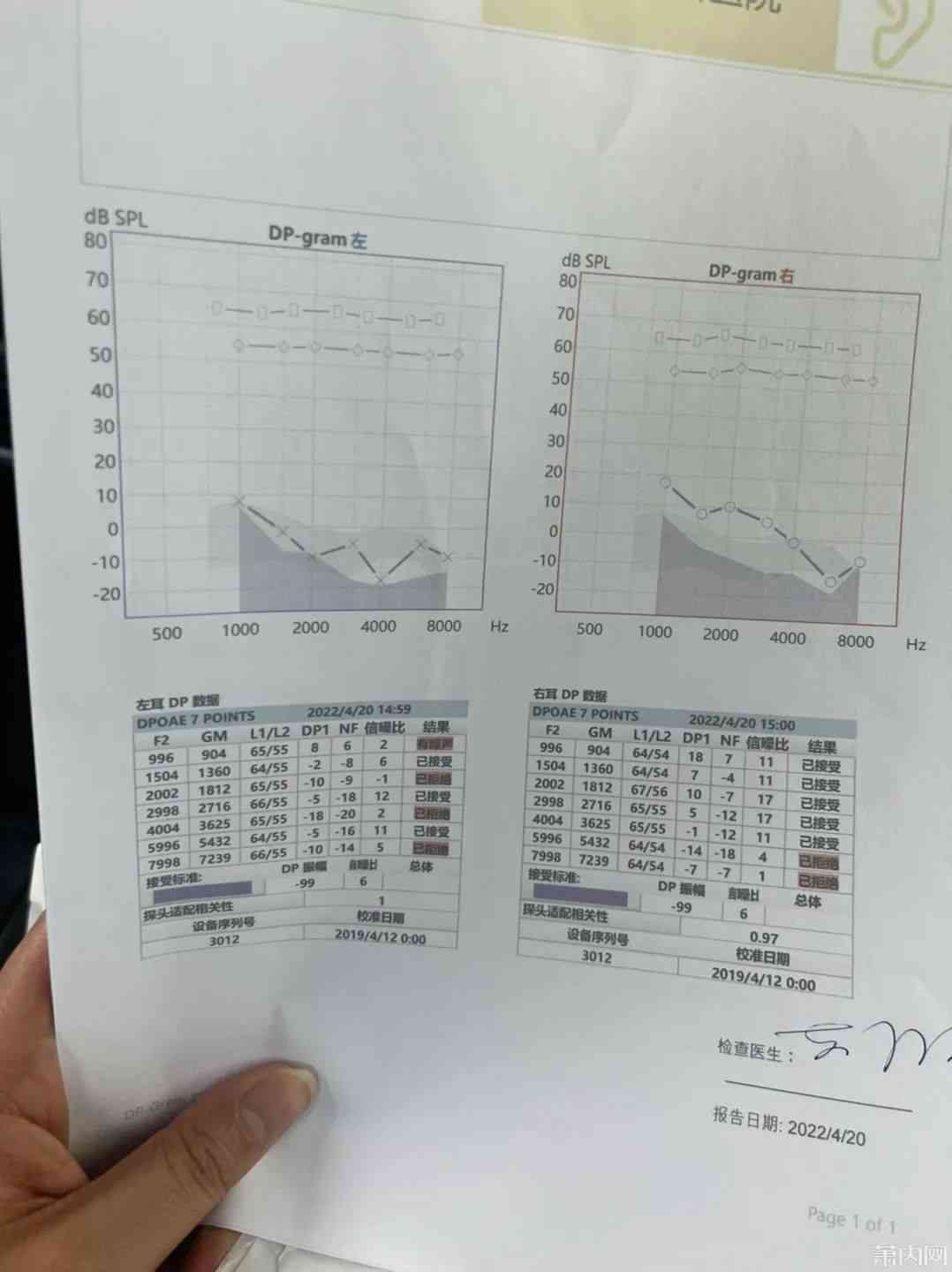 高精度纯音听力评估报告与分析