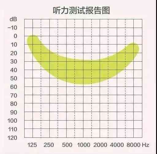 高精度纯音听力评估报告与分析