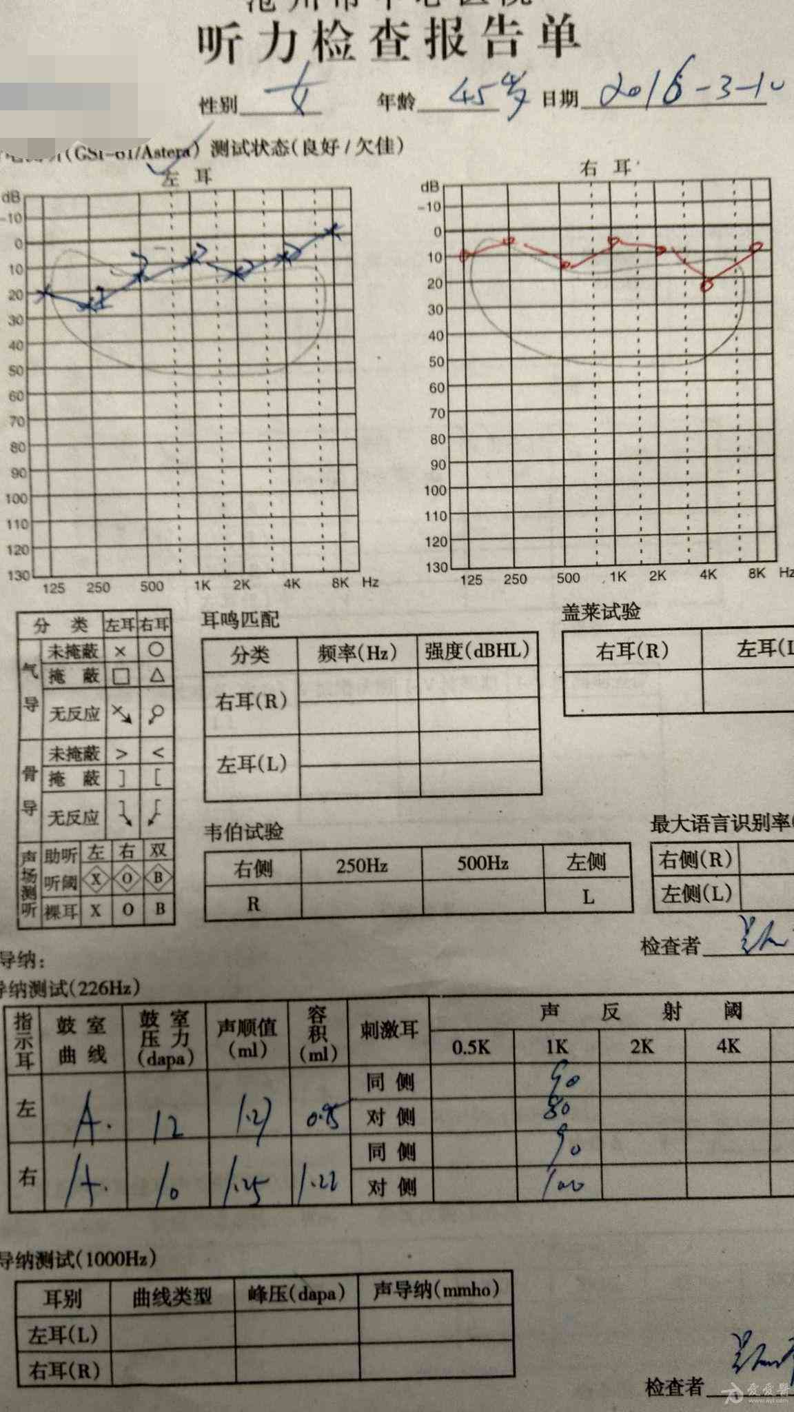 高精度纯音听力评估报告与分析