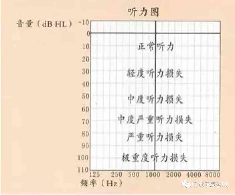 全面解读纯音听力检测报告：ACBC各项指标意义与耳聋类型分析