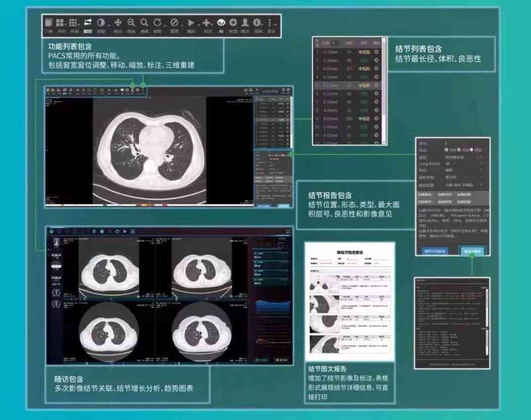 天津胸科医院ai检测报告查询：体检、CT报告官网查询系统及结果