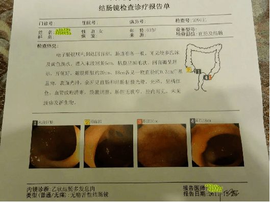 骨龄AI报告准不准怎么看：详解骨龄检测报告单解读方法