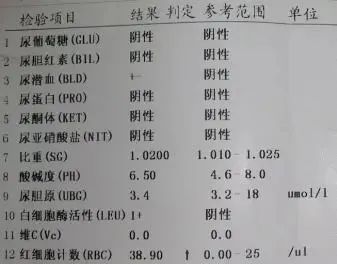 骨龄AI报告准不准怎么看：详解骨龄检测报告单解读方法