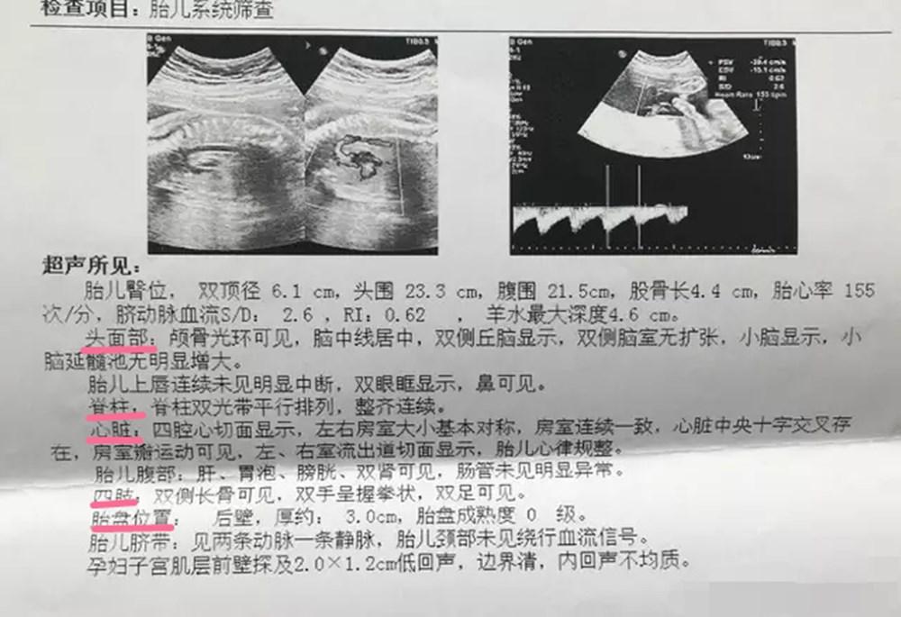 揭晓宝宝四维彩超结果：全面解读宝宝发育状况的精彩瞬间