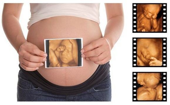 孕期四维彩超解读：胎儿健筛查全攻略