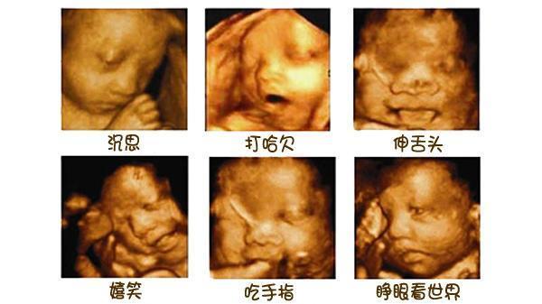 孕期四维彩超解读：胎儿健筛查全攻略