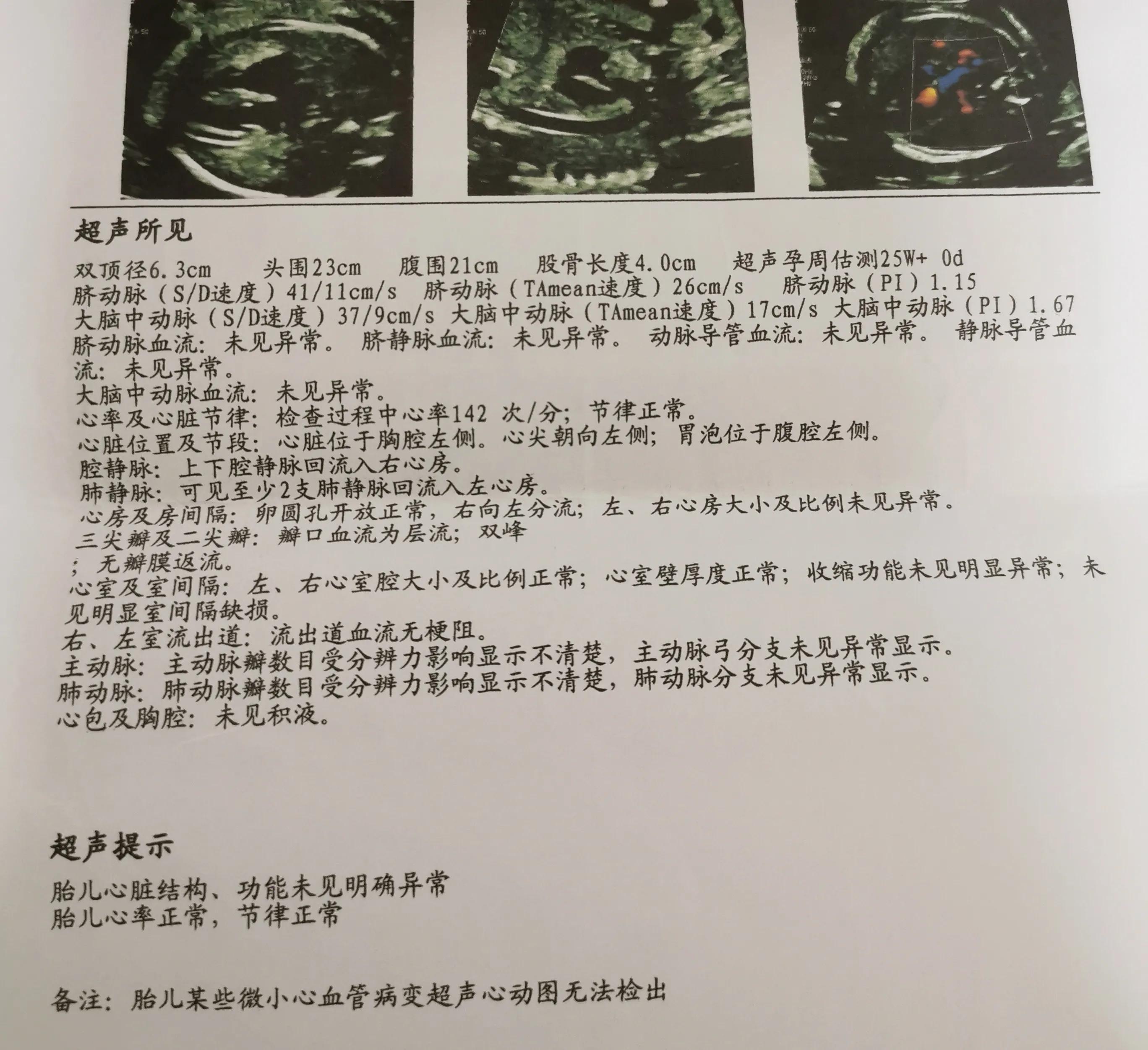 孕妇产检报告单-孕妇产检报告单图片
