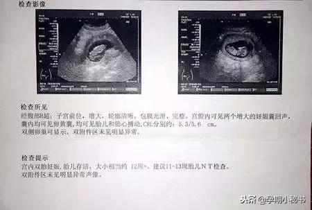 孕期产检报告Mom：全面解读母体与胎儿健康状况