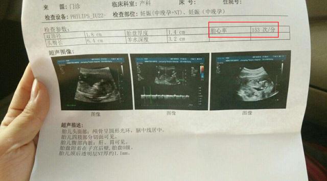 孕期产检报告Mom：全面解读母体与胎儿健康状况