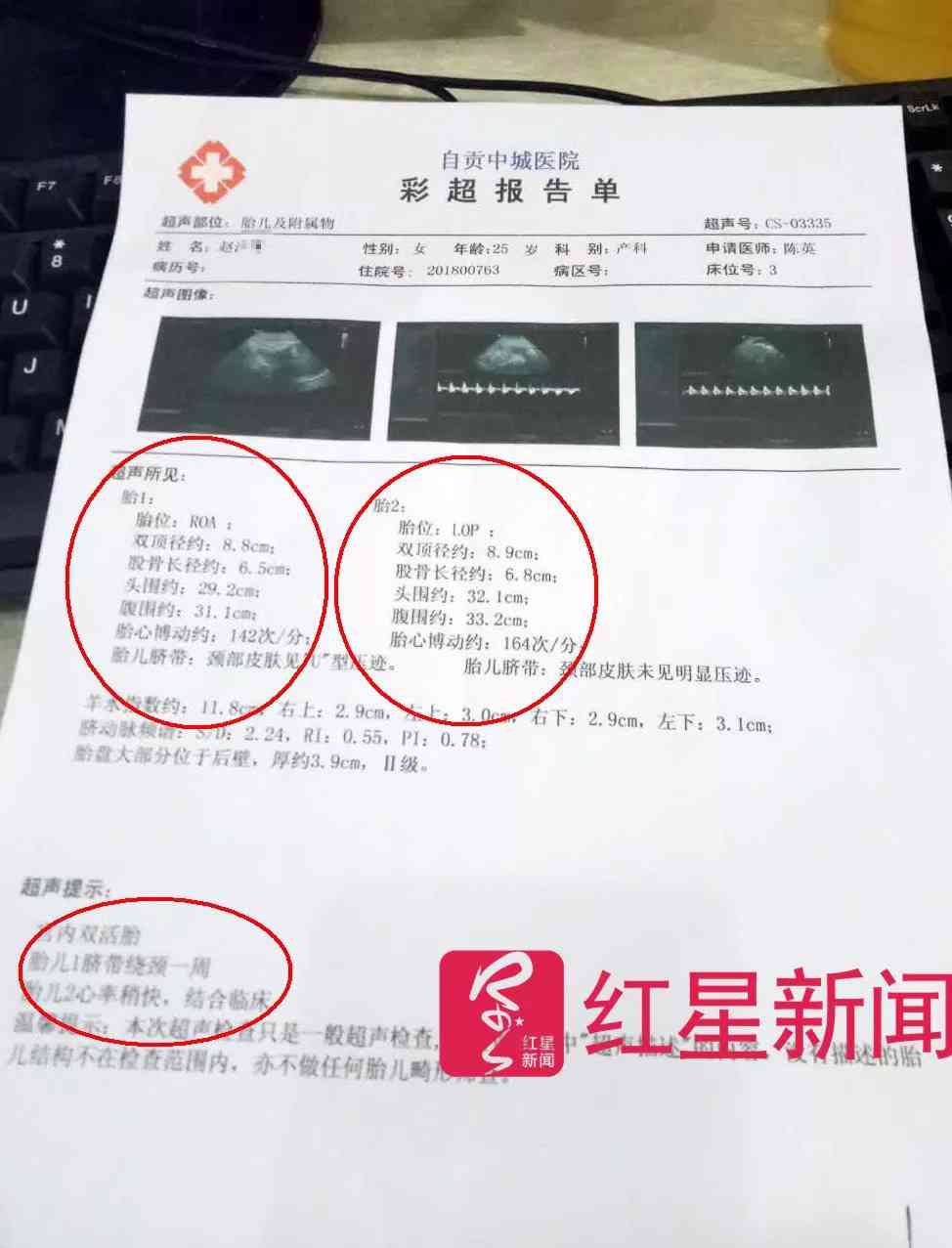 ai产检报告单