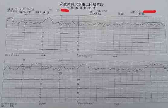 ai产检报告单