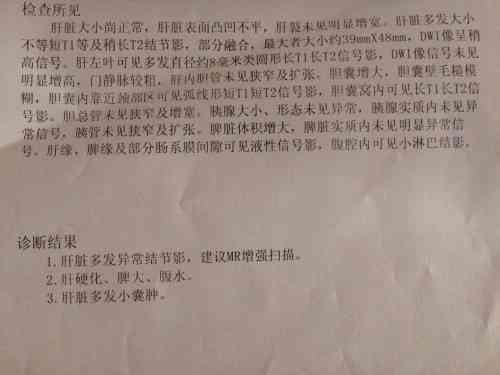 全方位解析：CT检查诊断报告单深度解读与常见问题解答