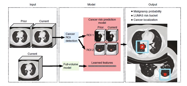 人工智能肺癌筛查原理与方案，包括项目及诊断，AI肺结节筛查准确率分析