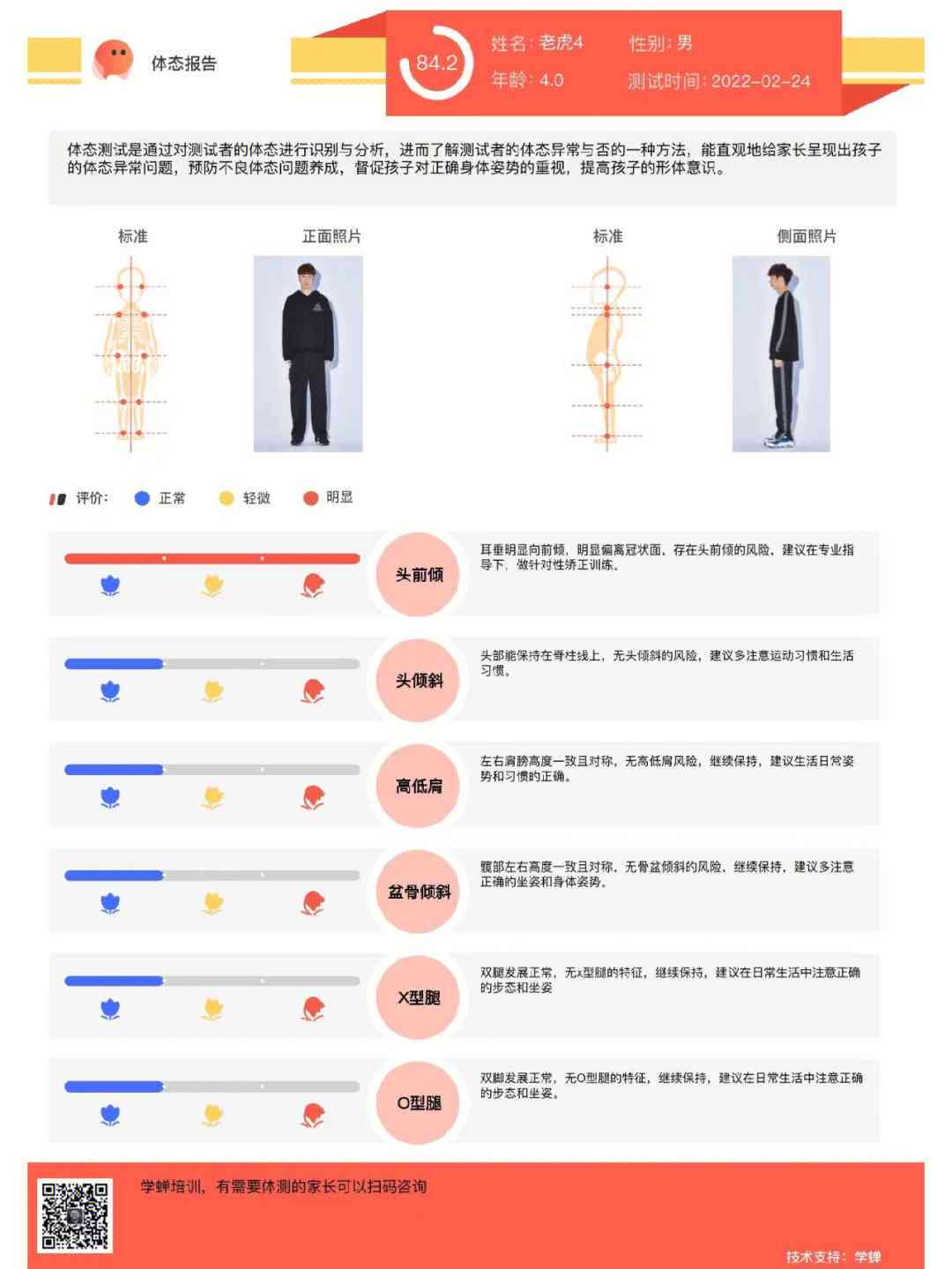 AI智能体态评估系统报告示范