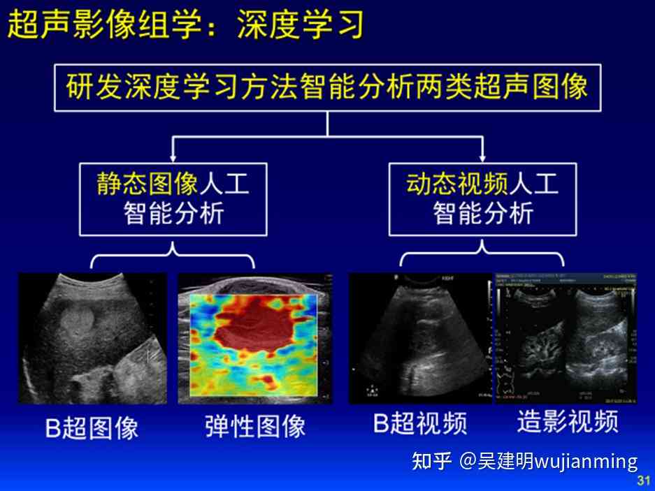 超声报告AI评估