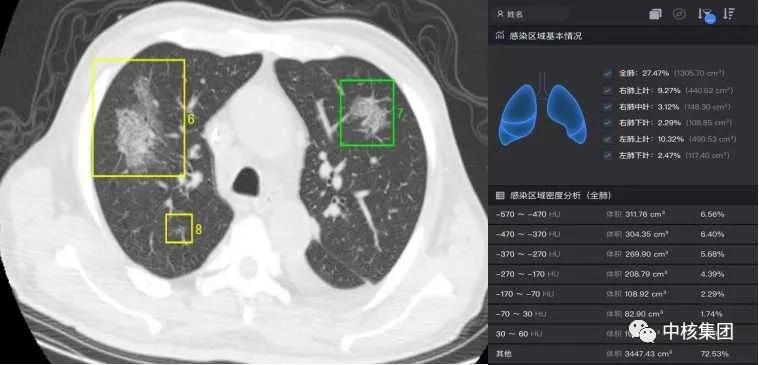 ai人工智能写诊断报告