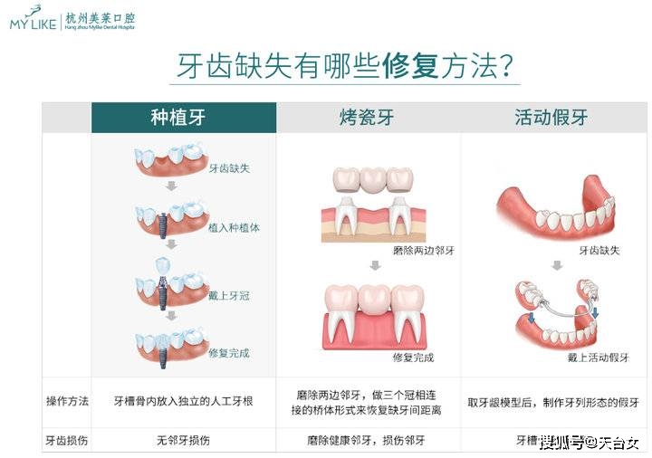 牙齿AI报告软件推荐：高效准确的口腔健康助手