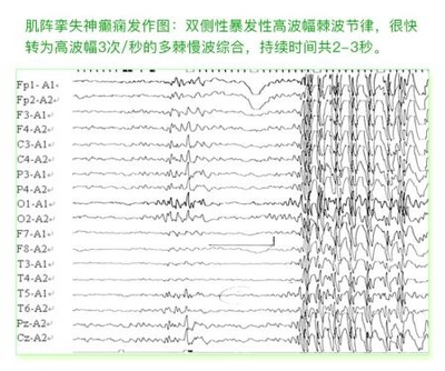 全面解析：听力测试报告AC的详细解读与常见问题解答