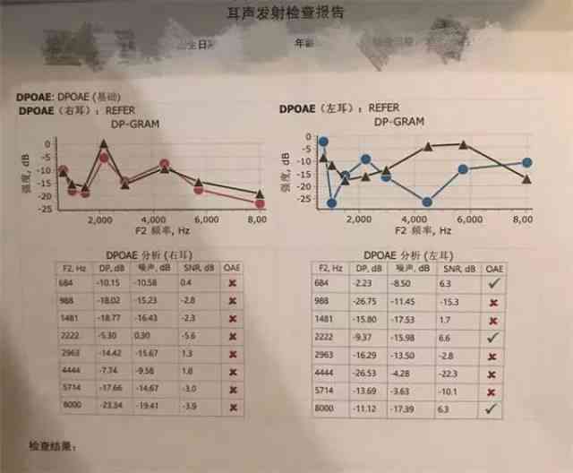 听力测试报告单ai是什么意思