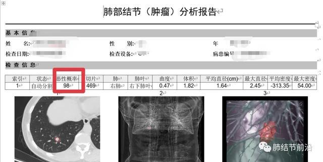 ai读片报告错误怎么办