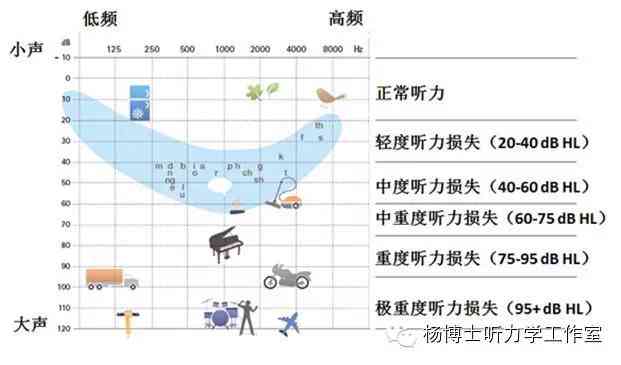 听力报告AI：含义解析及类型对比