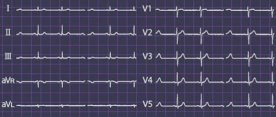 全面解读心电检查报告单：从结果到临床意义