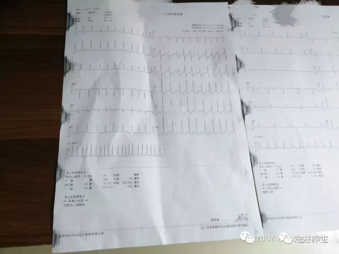 全面解读心电检查报告单：从结果到临床意义