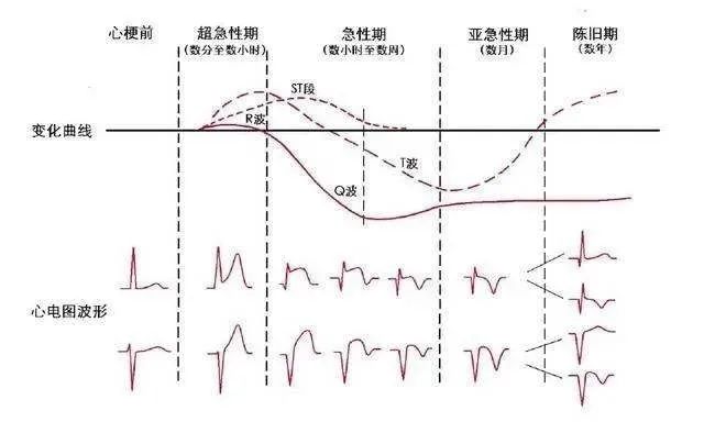 全面解读心电检查报告单：从结果到临床意义