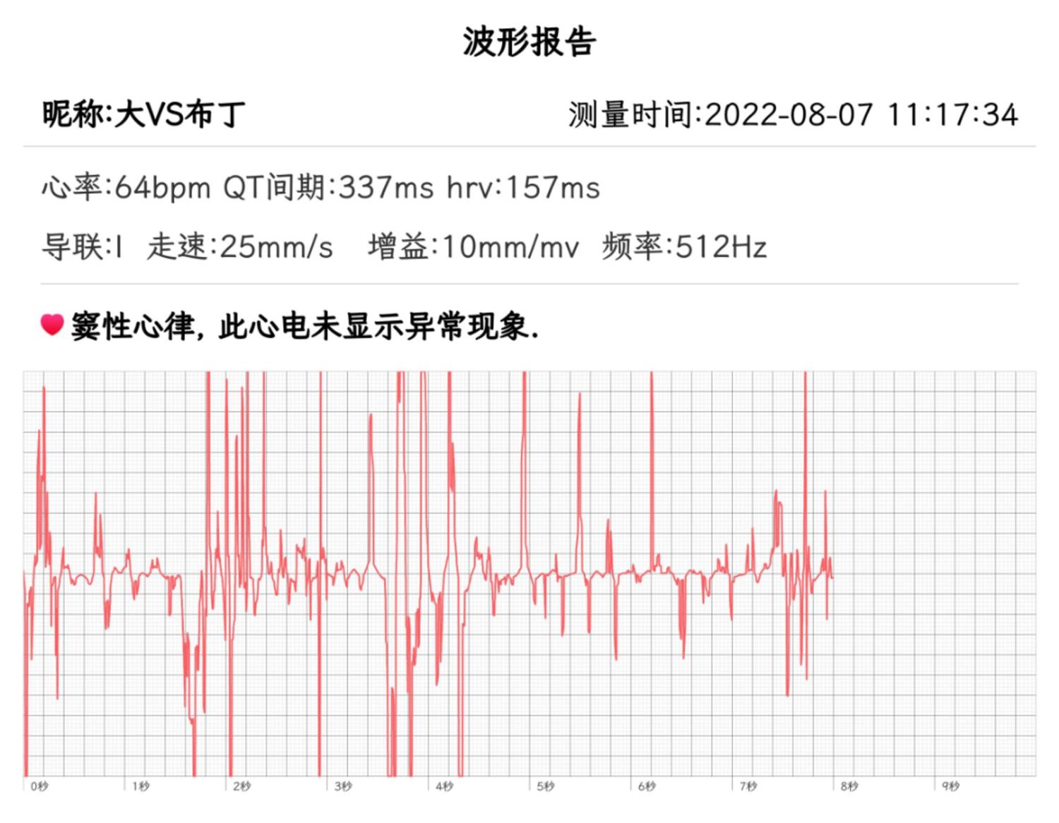 心电ai报告