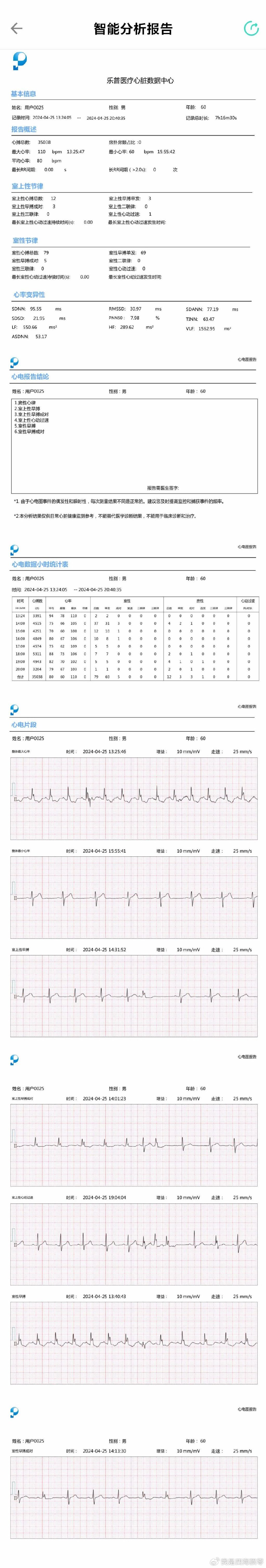 心电ai报告