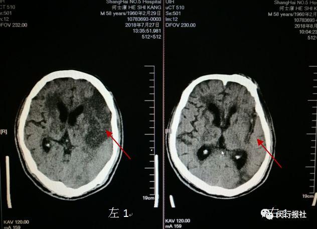 揭秘AI数据标注员的职责：从数据预处理到模型训练的关键角色解读